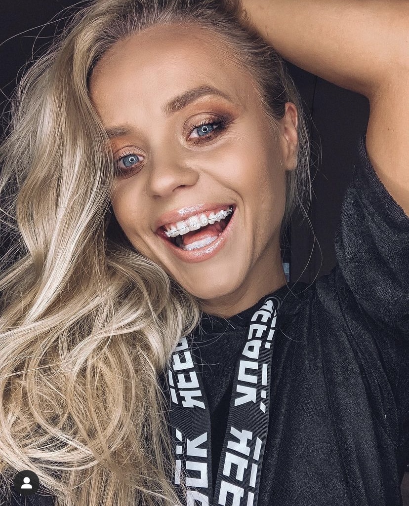 Czy warto nosić aparat ortodontyczny?